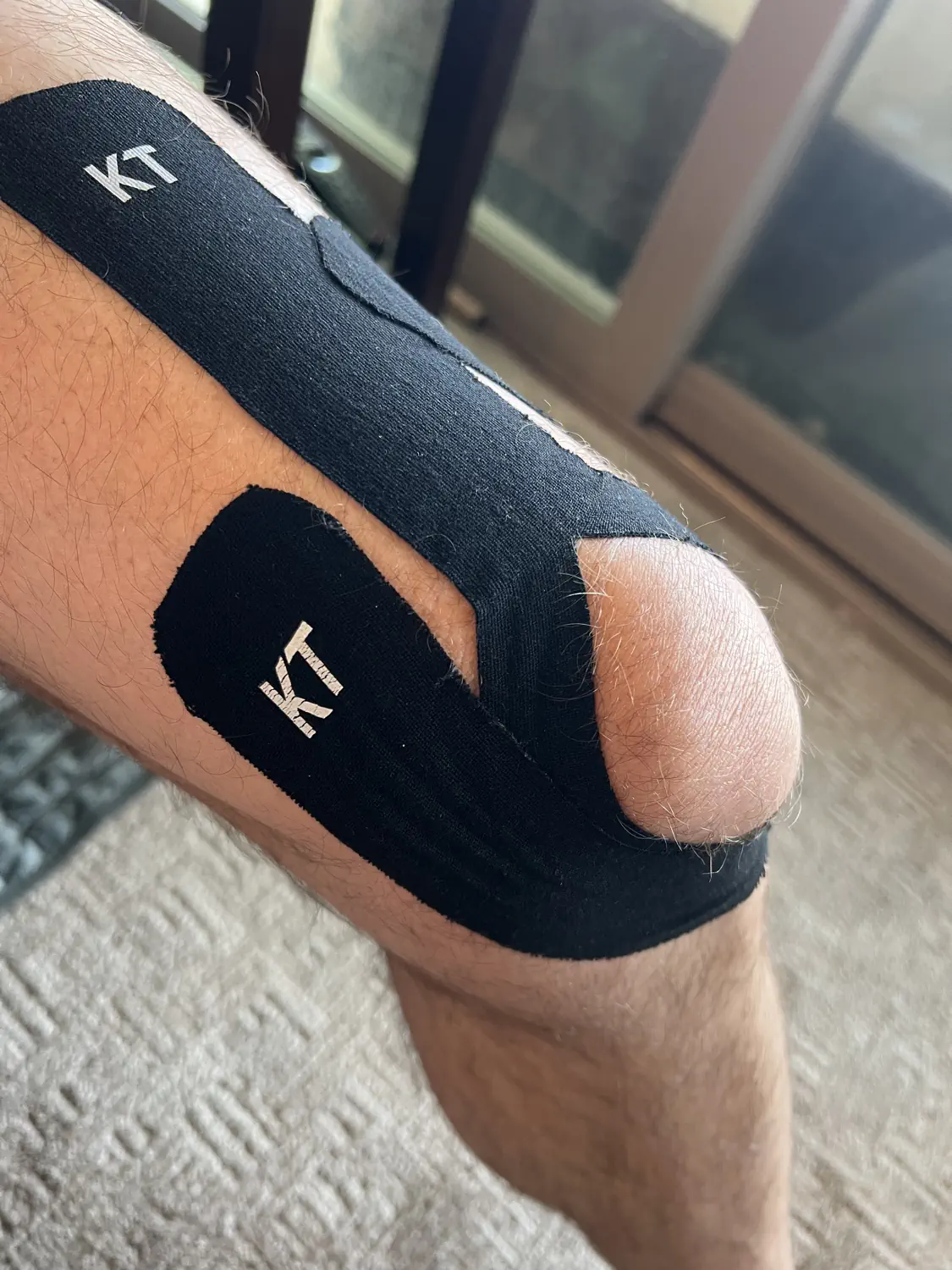 Keith has applied KT Tape to his knee to help aid the recovery process